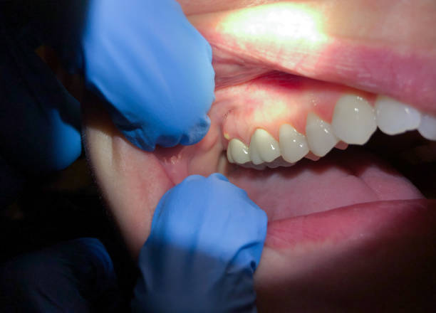  Porcupine, SD Emergency Dentist Pros