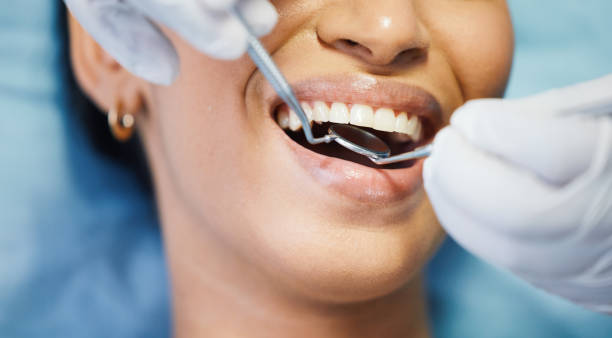 Best Emergency Broken Tooth Repair in Porcupine, SD